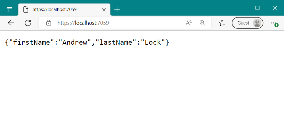 A Carter app looks the same as a standard minimal API